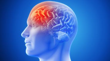 Quienes padecen migraña y presentan un cuadro de depresión o trastornos del sueño, reportan una calidad de vida significativamente peor.