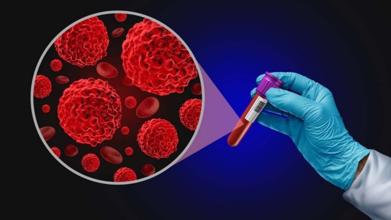 Se trata de un tipo de cáncer hematológico que se origina en las células plasmáticas.