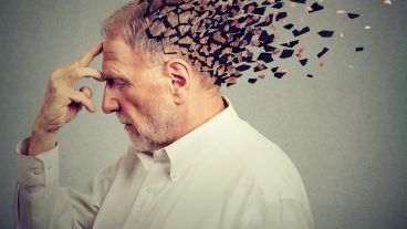 El Alzheimer es la forma más común de demencia, presentada con cambios progresivos en la memoria, lenguaje y otras funciones cognitivas.