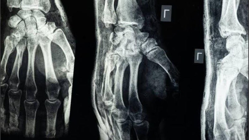 Los investigadores se inspiraron en las ostras para crear el producto.