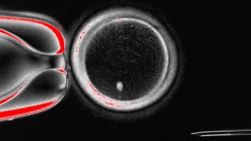 Para los autores se trata de una prueba de concepto que demuestra la viabilidad de generar gametos humanos por medio de células somáticas.