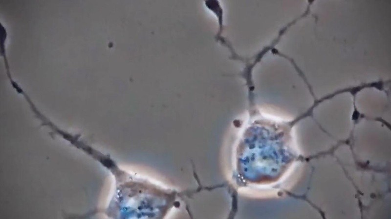 Los investigadores creen que la vacuna podría ser efectiva en humanos en los próximos años.