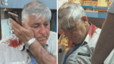 El agresor arremetió contra el agente de movilidad, que terminó con lesiones en la cabeza.