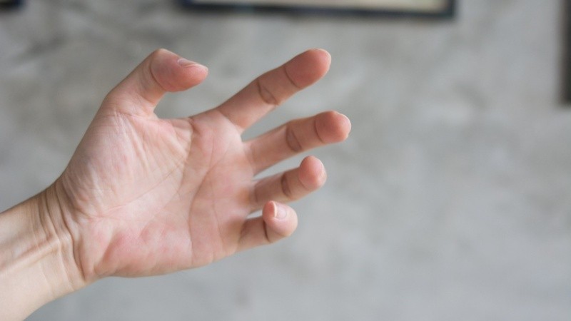 Un trastorno motor que aparece como consecuencia de una lesión en el sistema nervioso central.