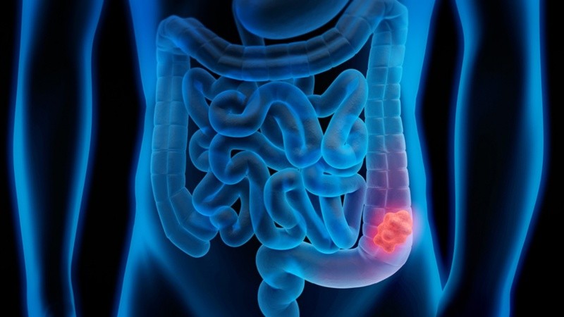 Comprender este circuito permite buscar soluciones más seguras y selectivas.