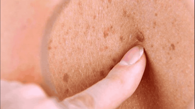 Se instalarán tres puestos informativos en Oroño y el río, Oroño y Pellegrini, y Francia y el río, de 9 a 12.