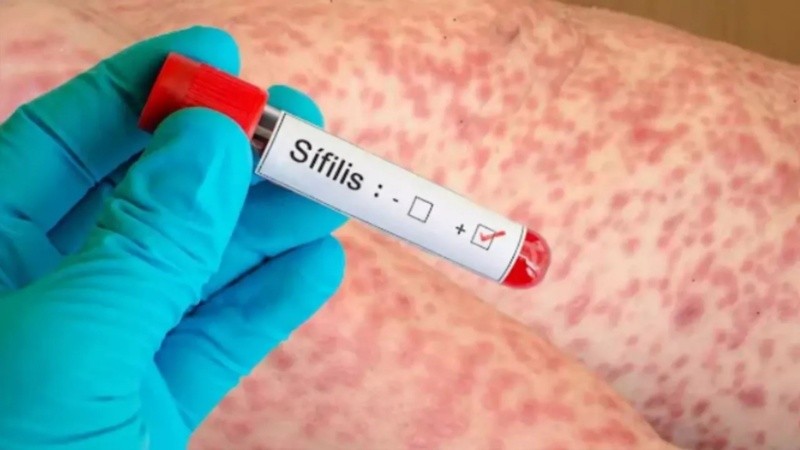 La mayor carga de enfermedad se centra en personas de entre 15 y 39 años, representando el 76% del total de casos.