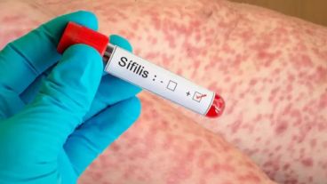 La mayor carga de enfermedad se centra en personas de entre 15 y 39 años, representando el 76% del total de casos.