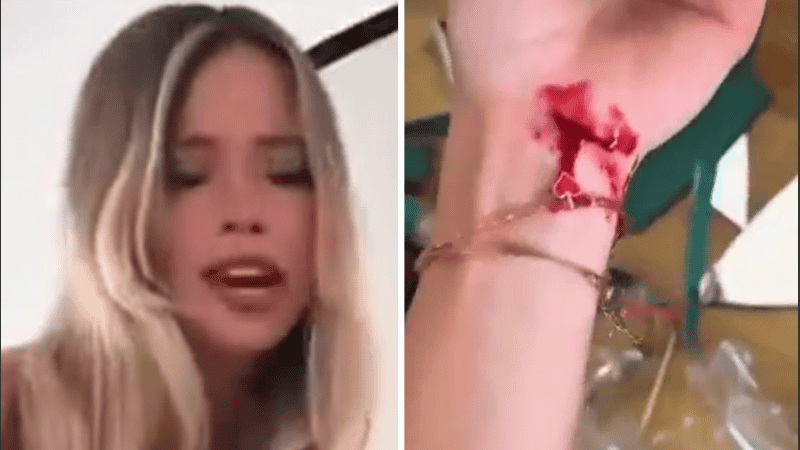 “Ahora no sé cómo reaccionar. No sé en qué momento pasó que lo fui a enchufar y se me vino el espejo encima”, relató.