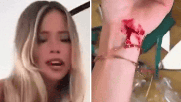 “Ahora no sé cómo reaccionar. No sé en qué momento pasó que lo fui a enchufar y se me vino el espejo encima”, relató.