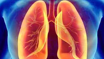Por primera vez, se dispone de un tratamiento que apunta a modificar la historia natural de la enfermedad