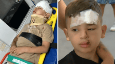 El niño de 6 años sufrió una fractura de cráneo y múltiples golpes; el conductor de la moto se dio a la fuga.