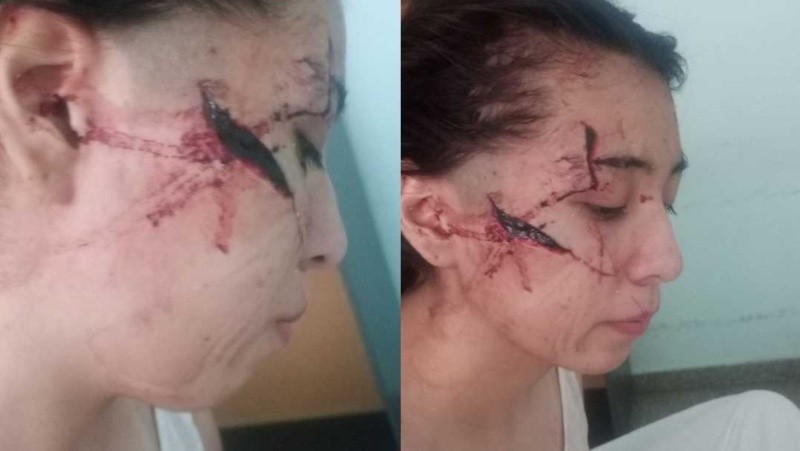 &nbsp;El rostro de la adolescente. 