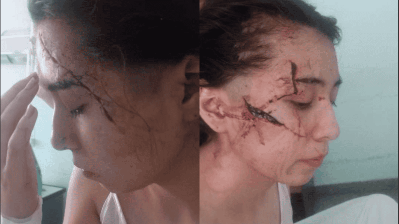 Investigan un hecho de agresión en la localidad santafesina de San Cristóbal, donde una adolescente de 15 años fue víctima de un brutal ataque.