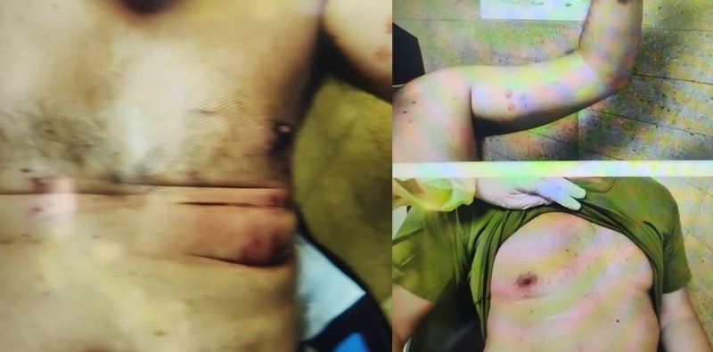 Las heridas provocadas por la metralla. Foto: gentileza Clarín.