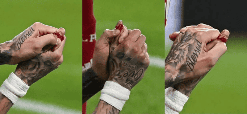 &nbsp;Así quedó el dedo del delantero. Foto Bolavip 