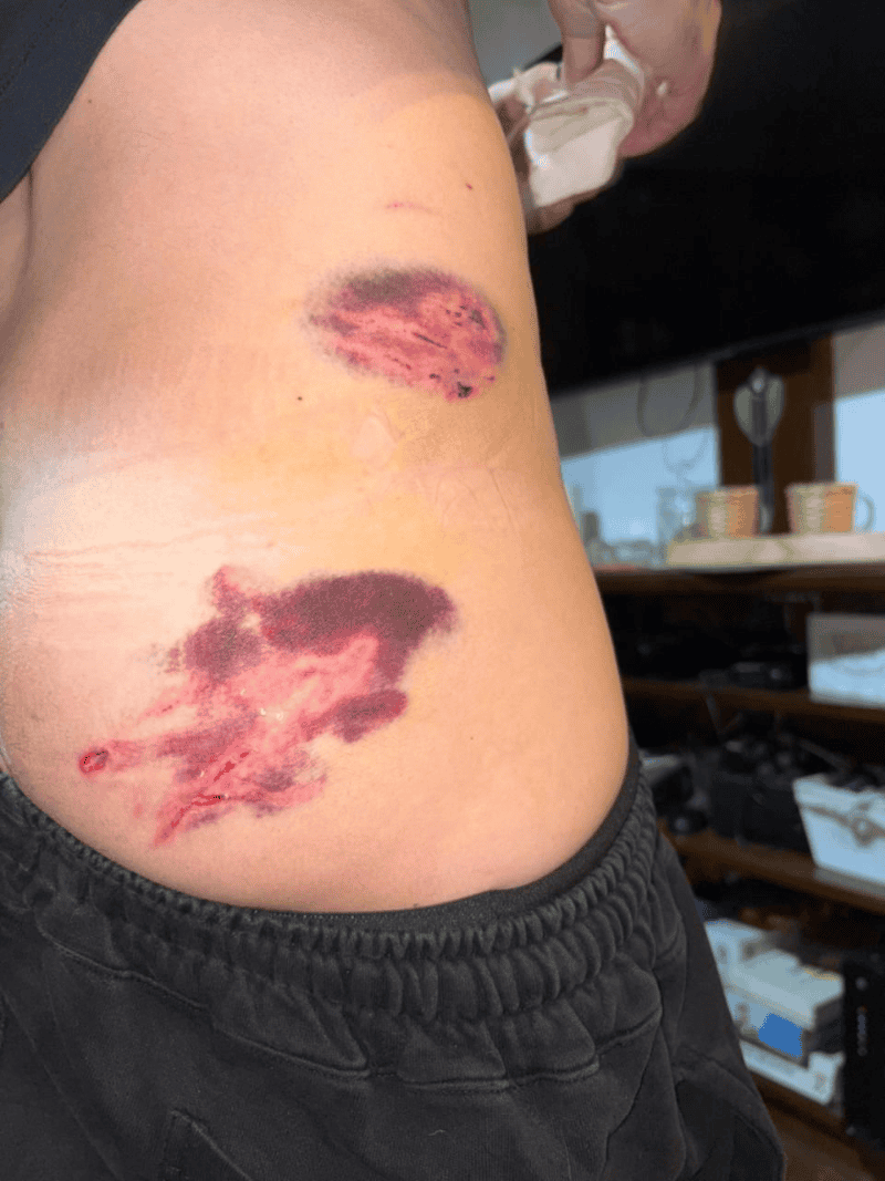 &nbsp;El operario sufrió heridas en distintas partes de su cuerpo.