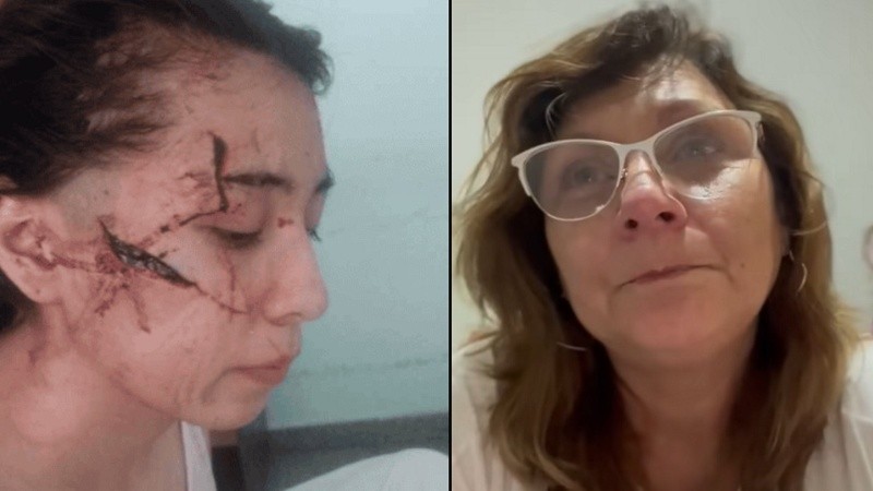 Delfina, la chica de 15 tajeada en la cara, y Sandra, la abuela de otra adolescente atacada.