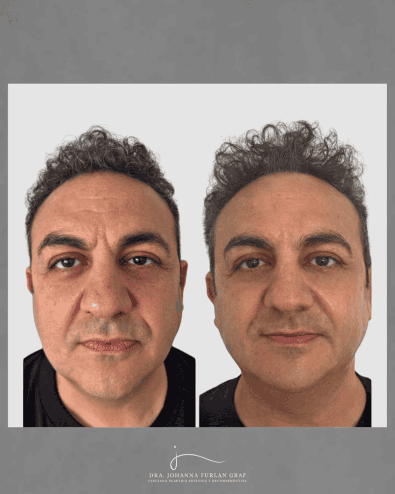 El antes y después de Diego Topa que publicó su médica.&nbsp;