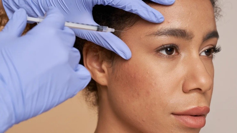 Anmat indicó que existen medicamentos con toxina botulínica habilitados en el país, pero que son productos de venta bajo receta.