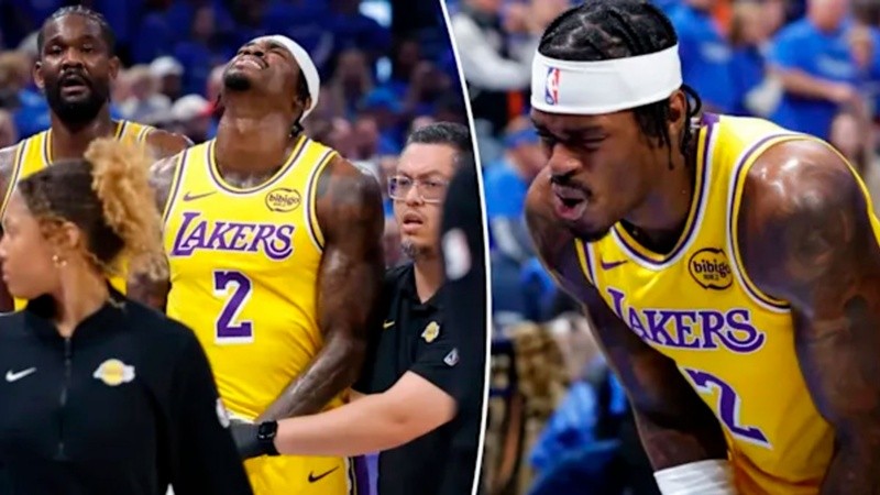 El jugador de los Lakers sufrió una luxación abierta.