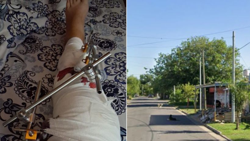 Ana deberá permanecer entre tres o cuatro meses postrada (Foto FM Horizonte/Google Street View).
