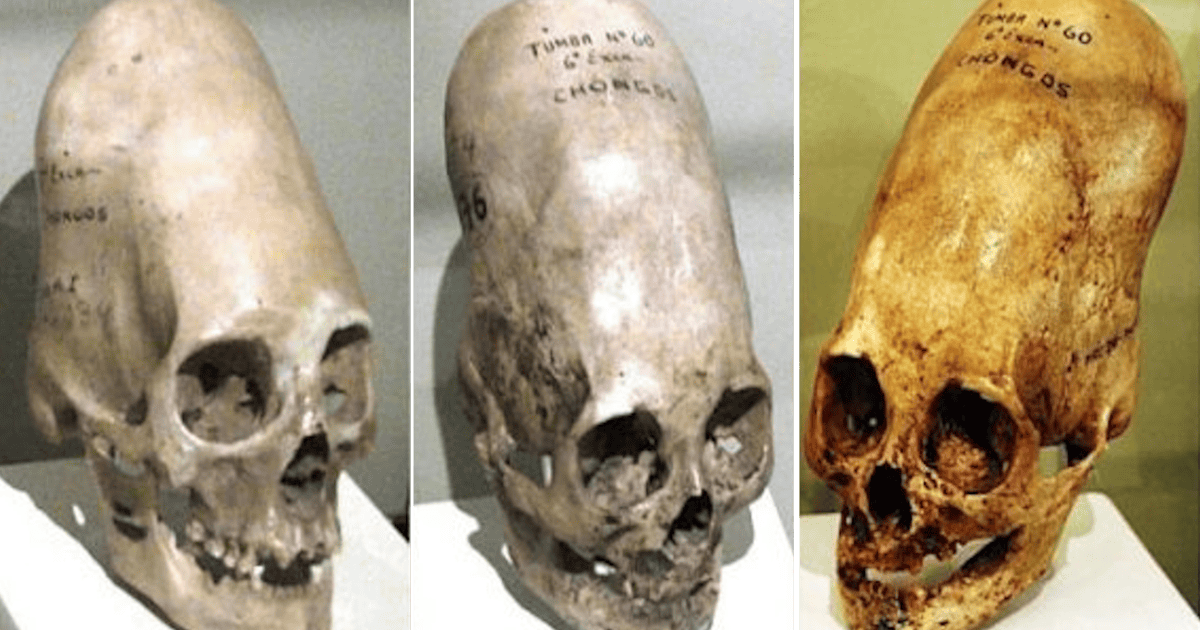 ¿Humanos o extraterrestres?: El ADN de las momias "cabeza de cono" de Perú sigue sin dar respuestas