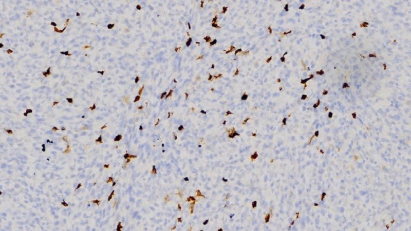 “Los resultados muestran que es posible actuar sobre el tumor mediante una aproximación completamente diferente a las estrategias convencionales y hacerlo, además, sin detectar efectos adversos en los animales tratados”, explicaron.