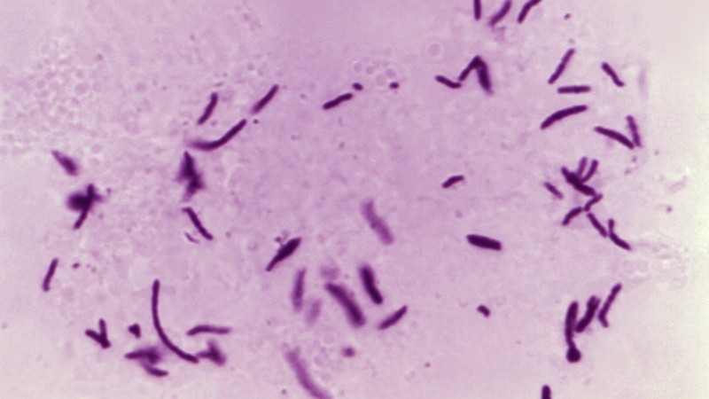 Un estudio logró reconstruir con un nivel de detalle sin precedentes el genoma completo de la bacteria que causa la enfermedad.