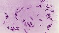 Un estudio logró reconstruir con un nivel de detalle sin precedentes el genoma completo de la bacteria que causa la enfermedad.