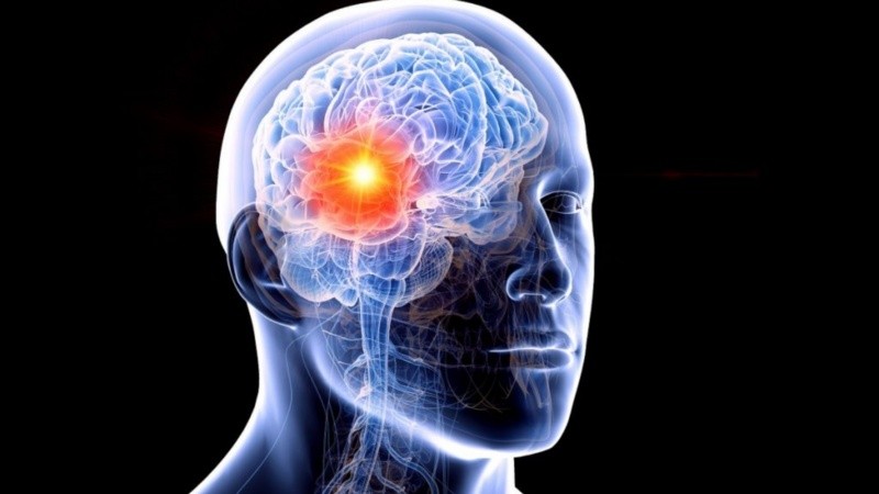 Especialistas advierten que el tratamiento debe contemplar la calidad de vida y no solo el control de las convulsiones.