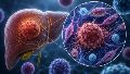 El hallazgo podría mejorar el tratamiento del cáncer de vías biliares intrahepático, una enfermedad poco frecuente que suele diagnosticarse en etapas avanzadas.