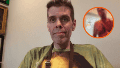 Perez Hilton permanece grave y deberá someterse a una cirugía.