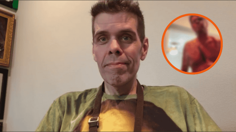 Perez Hilton permanece grave y deberá someterse a una cirugía.
