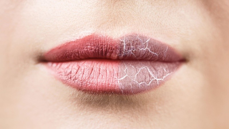 El frío, el viento y la calefacción pueden dejar los labios resecos y agrietados.