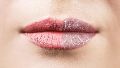 El frío, el viento y la calefacción pueden dejar los labios resecos y agrietados.