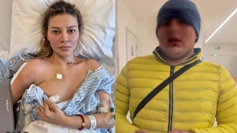 Beller apuntó a un sujeto de campera amarilla que intentó entrar a su habitación.