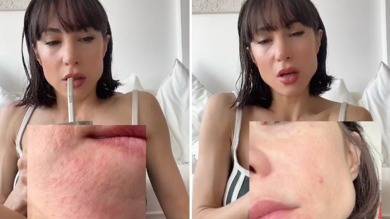 La artista contó cómo reaccionó su piel