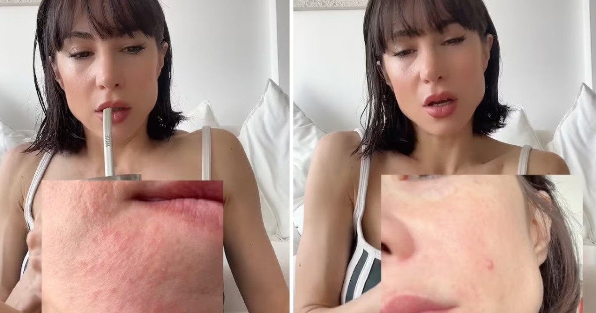 Magui Bravi reveló el grave impacto en su salud tras su separación: "Casi se me cae la piel de la cara"