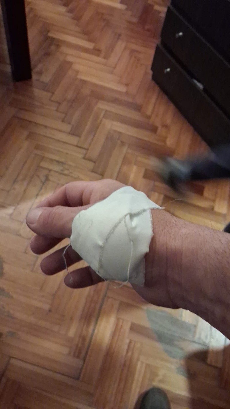 Las consecuencias del ataque de los perros.