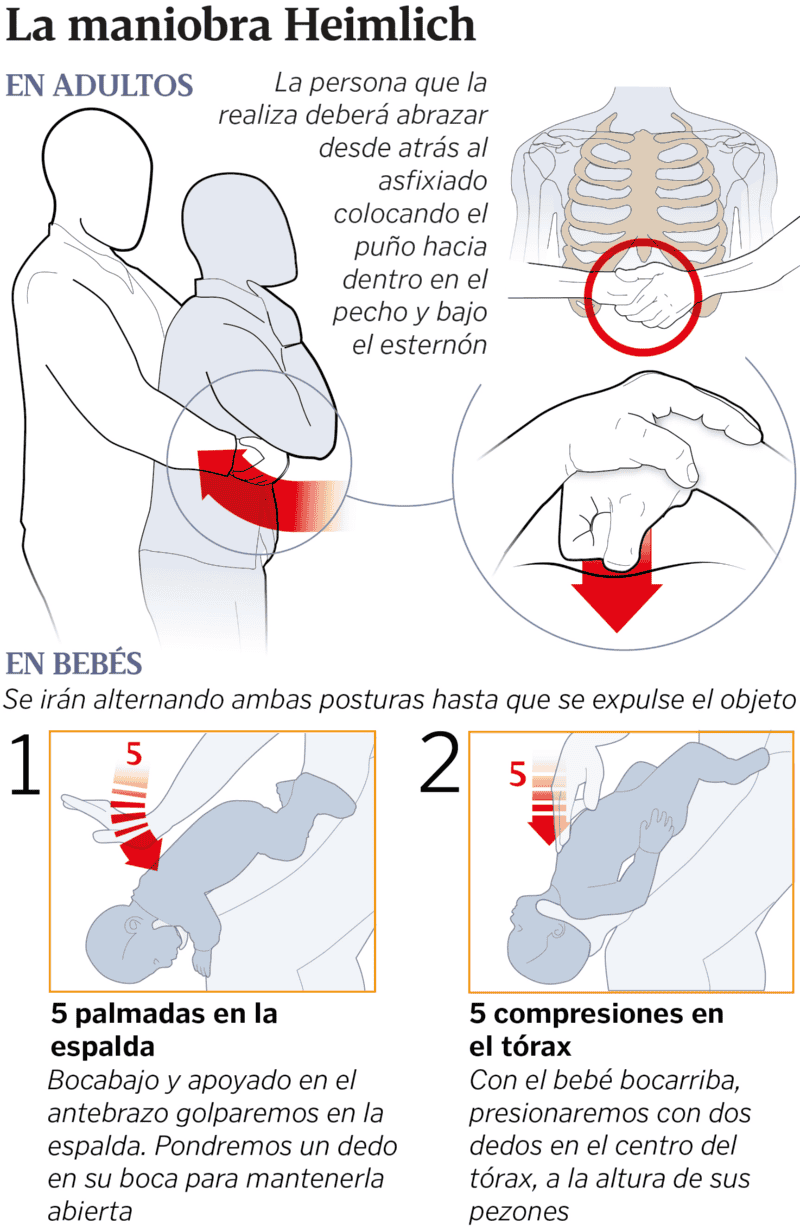 La maniobra de Heimlich.