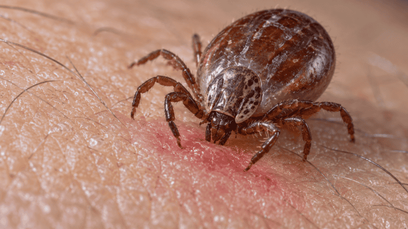 El microorganismo infecta tanto a seres humanos como a animales. (imagen IA)
