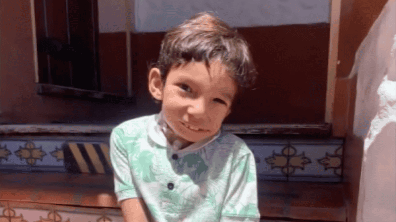 Bauti necesita una nueva cirugía para mejorar su calidad de vida.