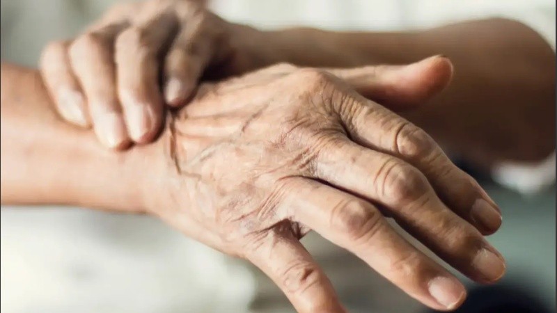La enfermedad de Parkinson es una de las enfermedades crónicas neurodegenerativas más frecuentes.
