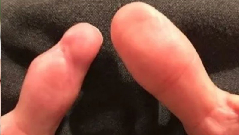 La mujer demandará al centro de estética.