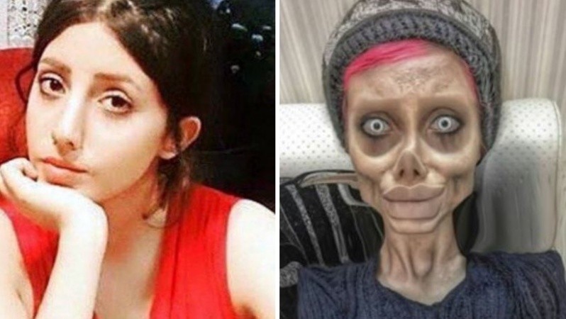 El antes y después de Sahar Tabar tras las cirugías.
