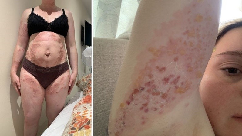 La mujer sufrió durante todo el embarazo.