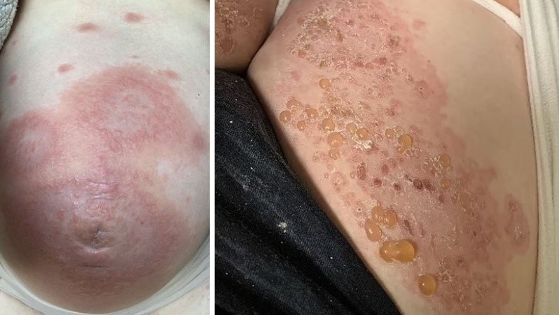 Ella y su esposo no tendrán más hijos.