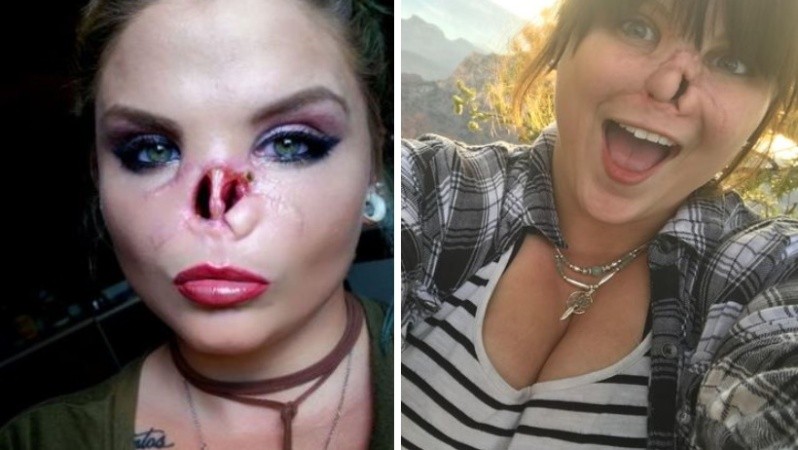 La joven debe volver al quirófano.