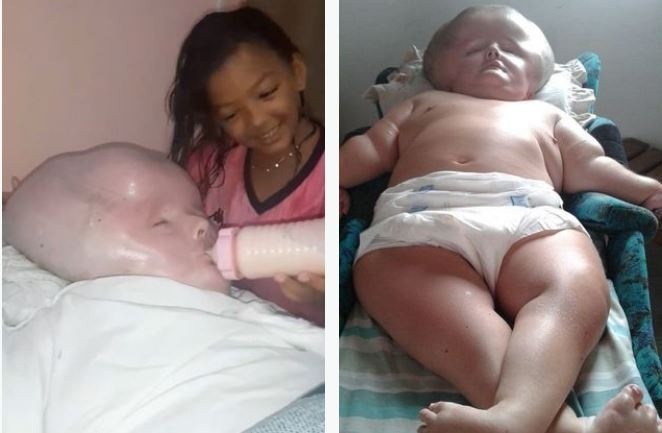 Le dieron pocos meses de vida pero superó todas las espectativas